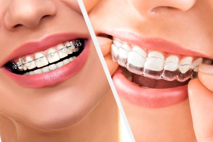 Equipment
