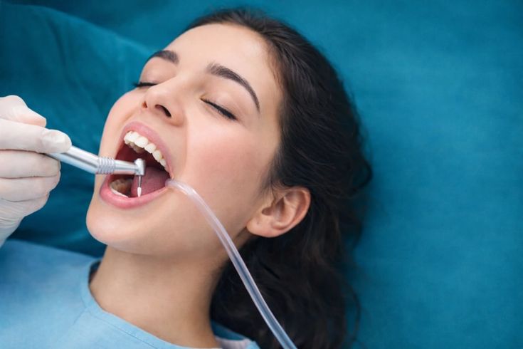 Root Canal